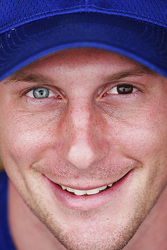 heterochromia eyes scherzer max different eye tigers colored iridium detroit color two ojos player complete lack google colors baseball tiger